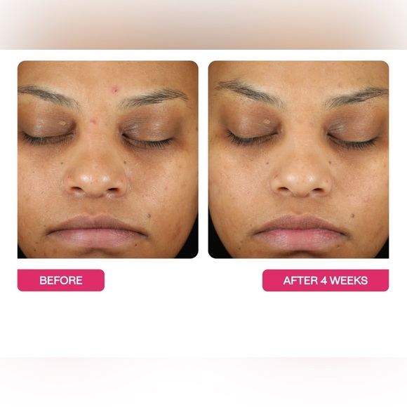 NIB BeautyStat Universal Triple Action Daily Peel Skincare Pads 10 Treatments! - Picture 9 of 16